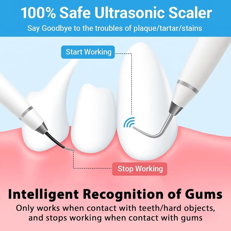 Dog & Cat Ultrasonic Dental Scaler & Cleaner